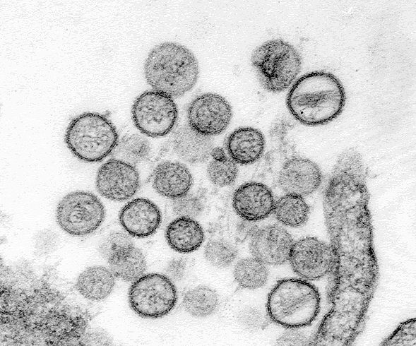 Sin Nombre Virus (credit: CDC Public Health Images Library)